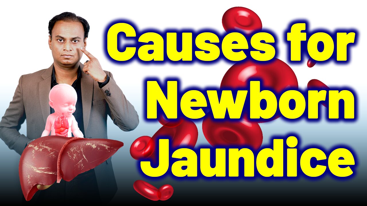 Causes for Newborn Jaundice, or Neonatal Jaundice .| Dr. Bharadwaz |