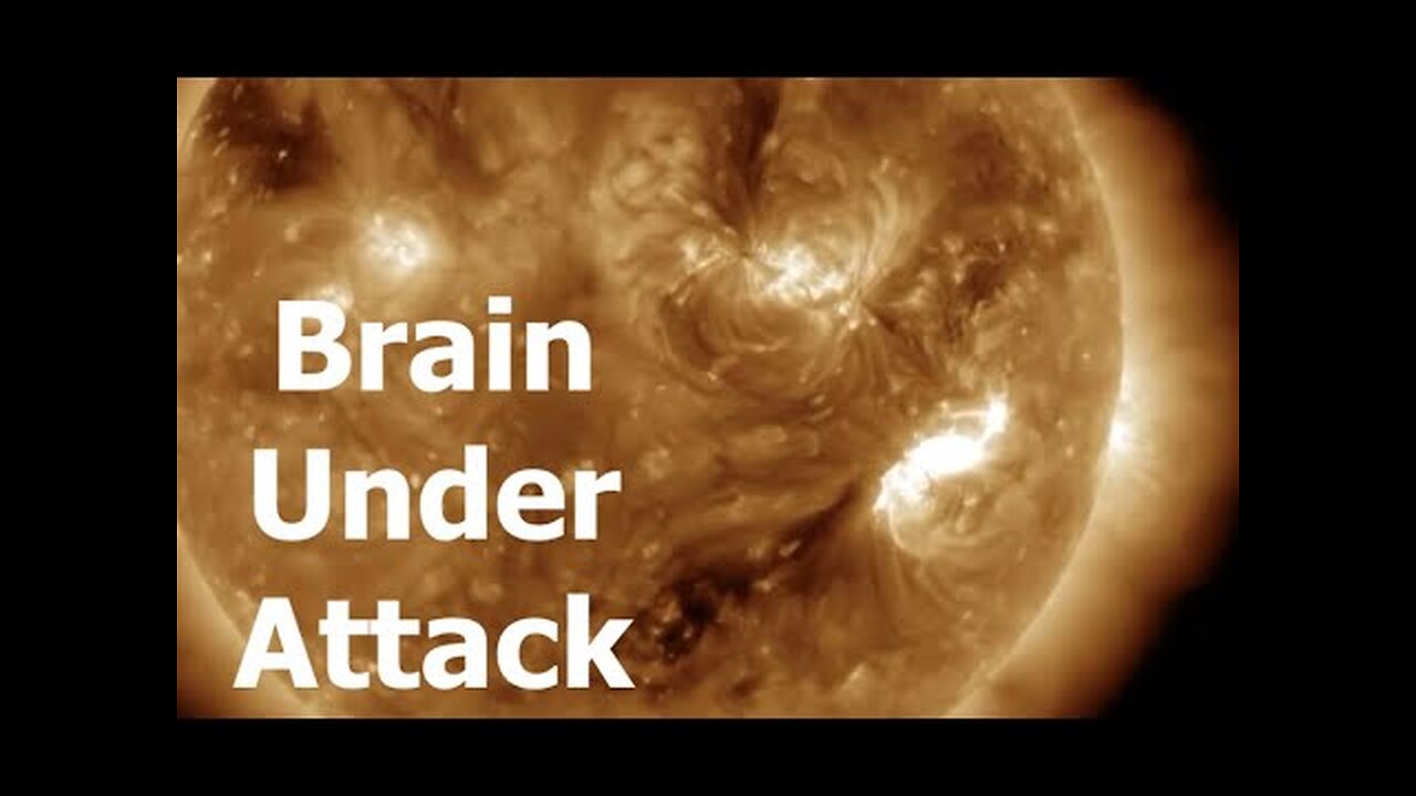 Sun & Pole Shift Attacking Our Brains