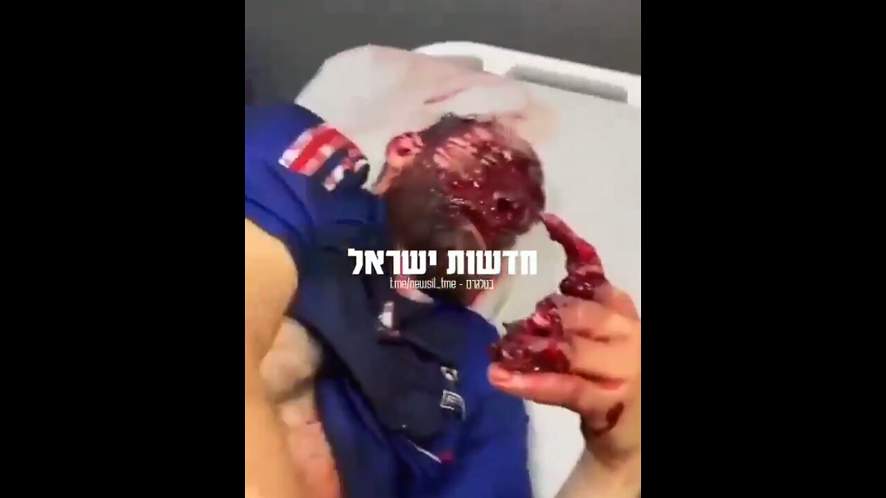 *GRAPHIC* - Pagers explode across Lebanon - Mossad/Israel behind attack 📟📵💥💣🧨🤯