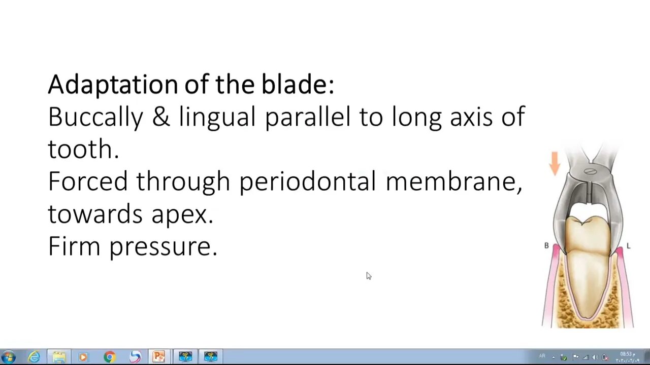 Oral Surgery L13 (Simple Tooth Extraction)