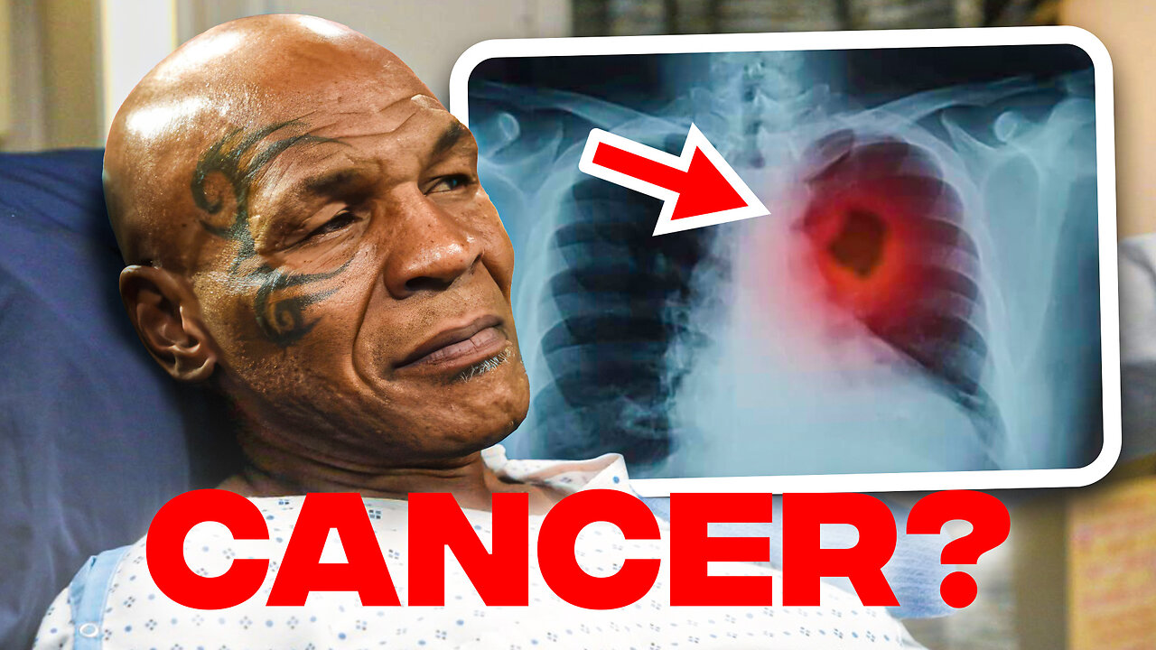 SHOCKING Update on Mike Tyson's Health Crisis