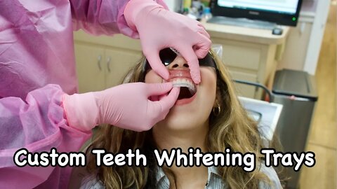 Brianna Custom Teeth Whitening Trays in 1080p