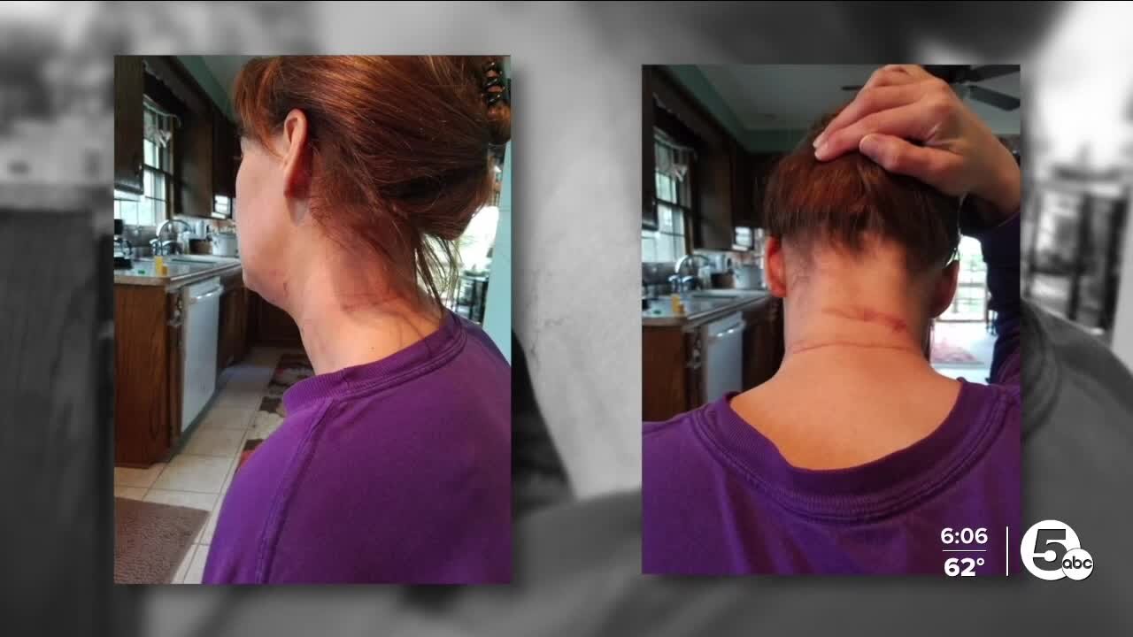 Law that makes strangulation a felony takes effect Tuesday in Ohio