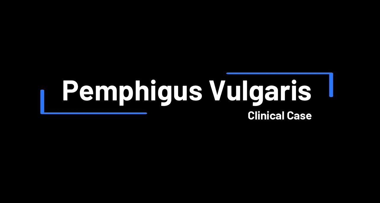 Pemphigus Vulgaris