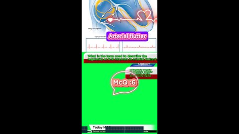 Arterial flutter #flutter -#arterialflutter #arrthythmia #CardiacArrhythmia #Cardiology 3D Medico