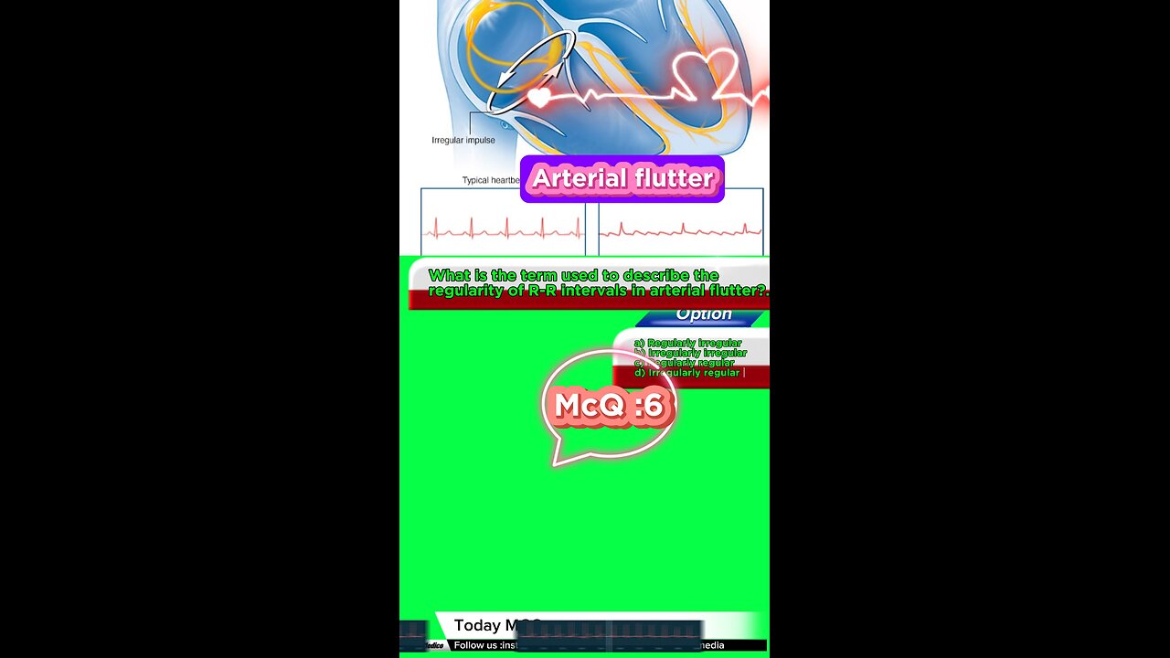 Arterial flutter #flutter -#arterialflutter #arrthythmia #CardiacArrhythmia #Cardiology 3D Medico