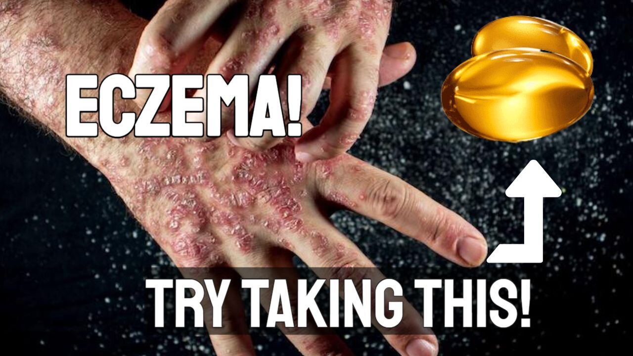 Vitamin E...A Natural Eczema Treatment?