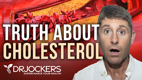 The Truth About Cholesterol (That Most Doctors Do Not Understand!)