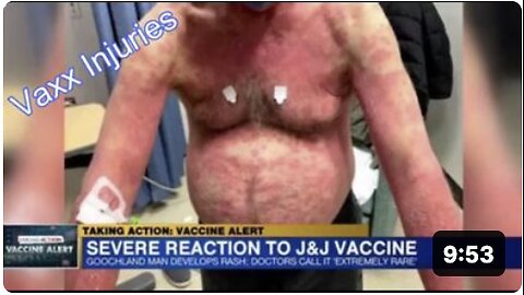 TOXIC SHOCK SYNDROME 💉 (IN THAT MOMENT) -- VIEWER DISCRETION IS ADVISED