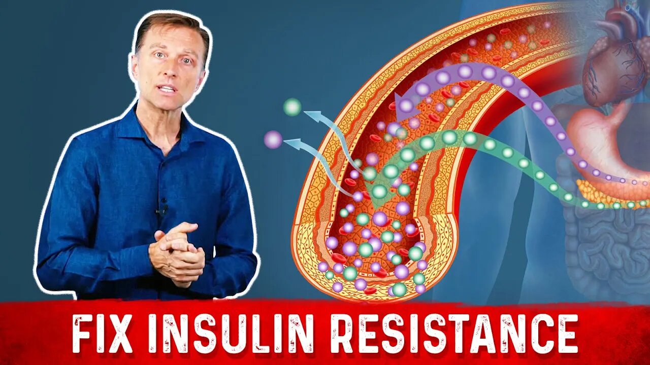 7 Things That Boost Insulin Sensitivity or Reverse Insulin Resistance - Dr. Berg