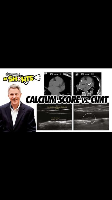 #SHORTS Calcium Score vs. CIMT