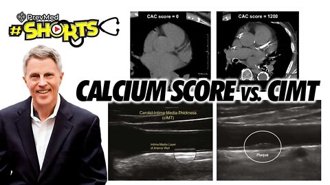 #SHORTS Calcium Score vs. CIMT