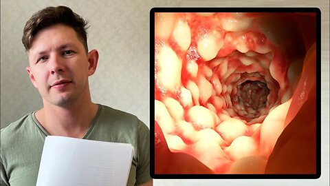 My CLASSIFIED Remedy for Colitis & Diarrhea