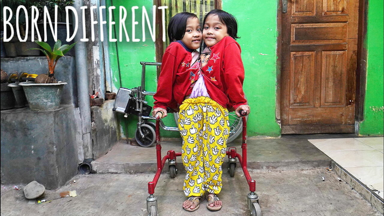 We're Conjoined Twins Who Share Legs | BORN DIFFERENT