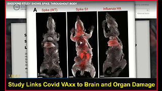 STUDY LINKS COVID VAxx to BRAIN and ORGAN DAMAGE (Highwire)