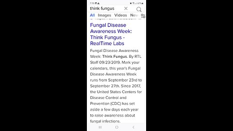 FUNGUS MISDIAGNOSED