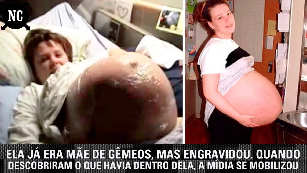 Ela já era mãe de gêmeos, mas engravidou. Quando descobriram o que havia dentro dela, a mídia se mob