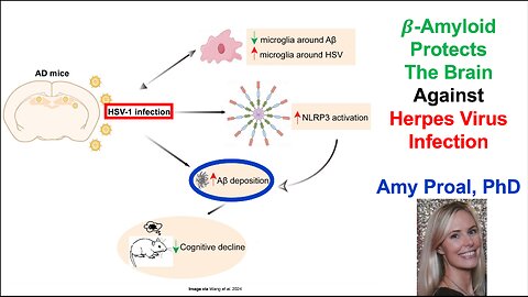 B-Amyloid Protects The Brain Against Herpes Virus Infection: Amy Proal, PhD