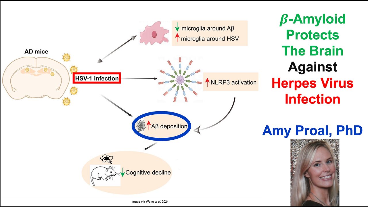 B-Amyloid Protects The Brain Against Herpes Virus Infection: Amy Proal, PhD