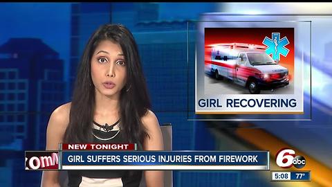 14-year-old girl injured from falling firework in Franklin, Indiana