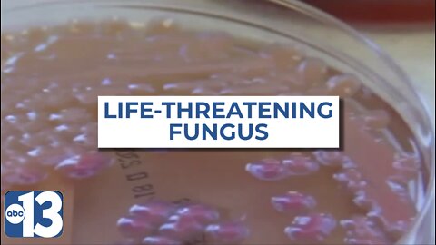 Antimicrobial-resistant fungus spreading in Las Vegas