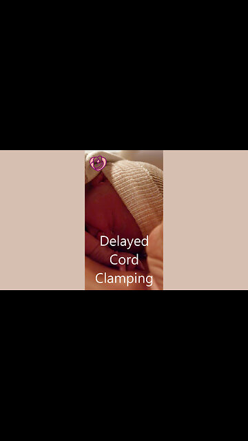 Delayed Umbilical Cord Clamping: 7 Benefits