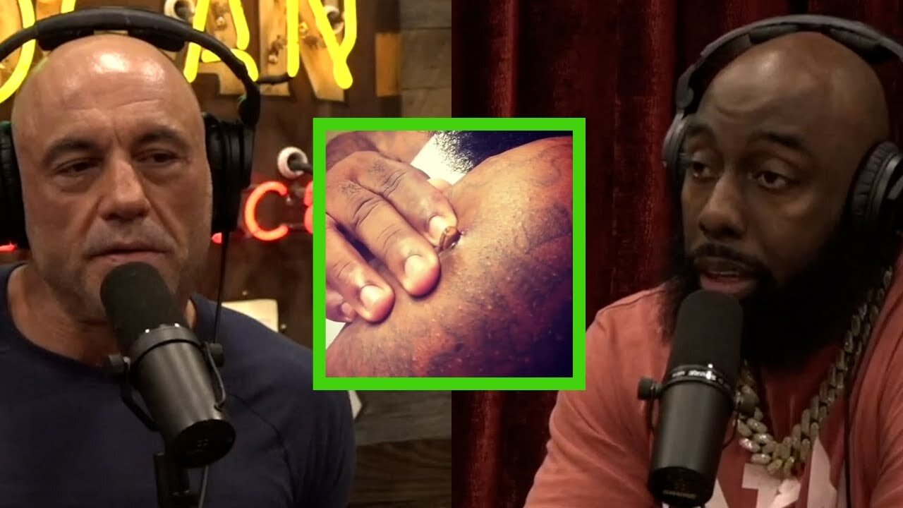 Trae the Truth on Getting Shot and Having the Bullet Stuck in His Arm