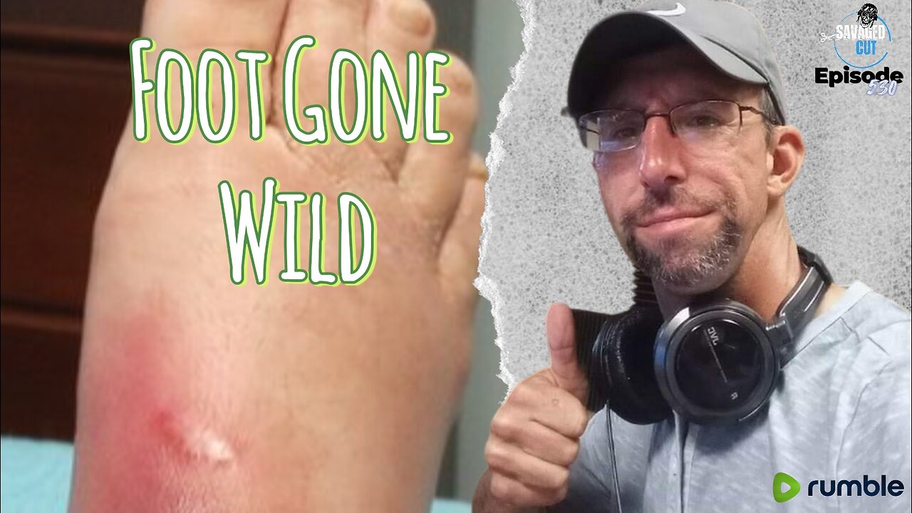 S5 • E530: Savaged Cut "Foot gone Wild"