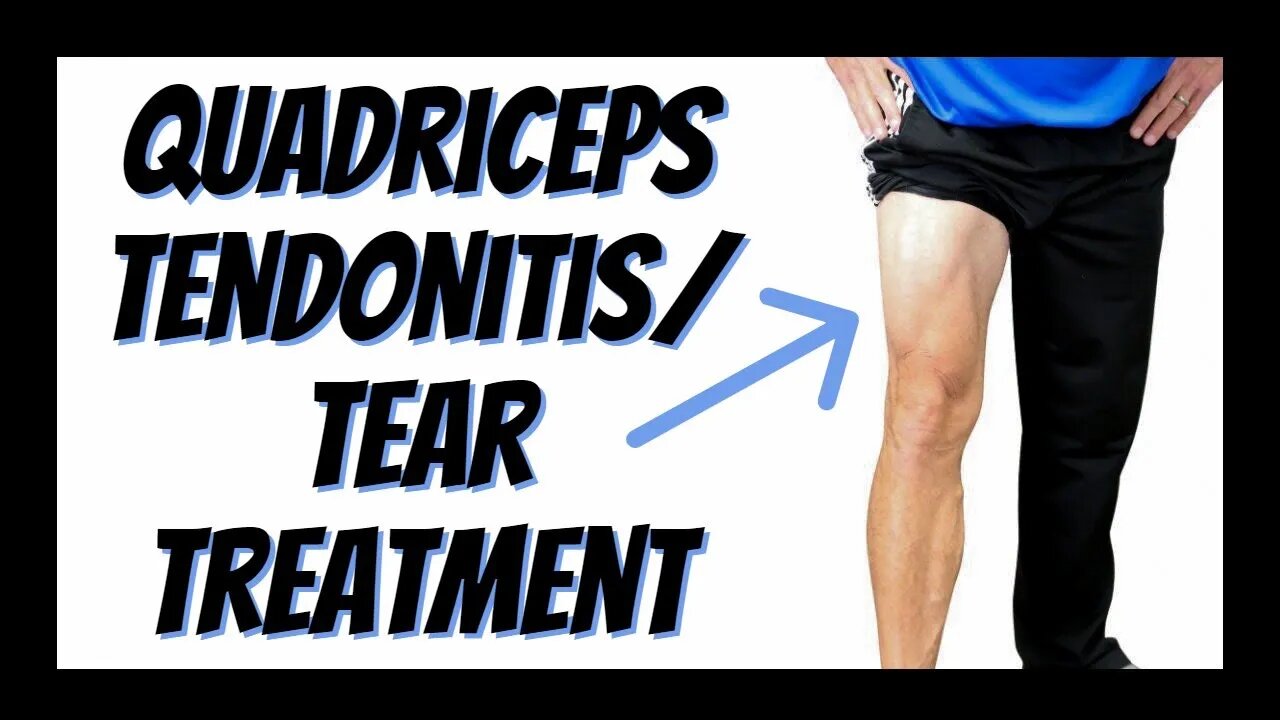 Quadriceps Tendonitis or Tear - Single Best Treatment You Can Do Yourself (Updated)