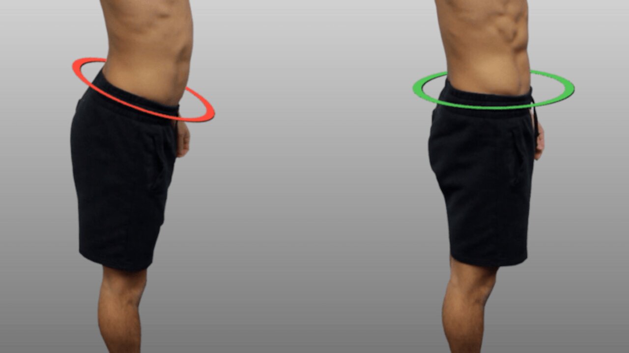 How to Fix Anterior Pelvic Tilt