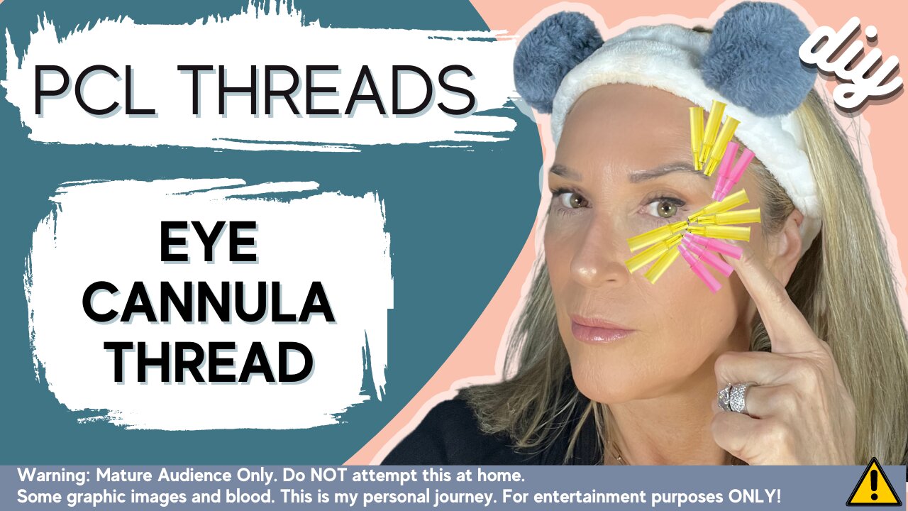 Look Younger & Refresh Your Eyes with PCL Thread Lift