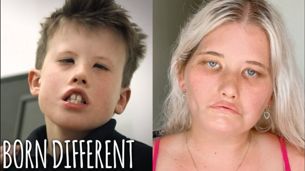 The People Who Can't Smile | BORN DIFFERENT