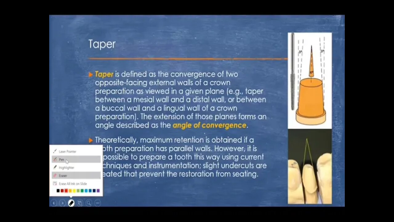 Operative L12 (Fixed Prosthodontics:Principles of Tooth Preparation Part2)