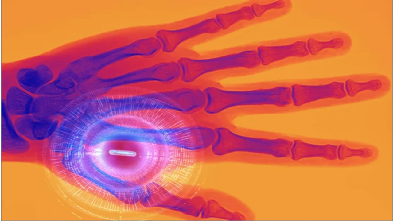 CBDC Chip Implants: German Economist Warns Central Bankers Plan To Issue Them