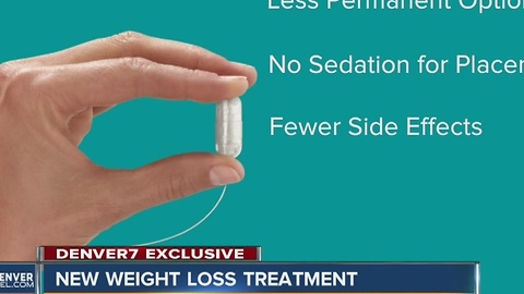 University of Colorado Hospital to offer new balloon capsule to boost weight loss