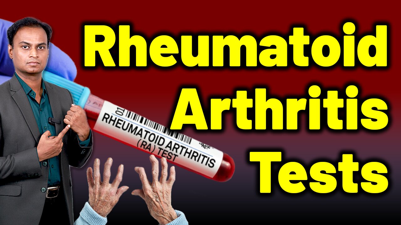 Tests and Investigations for Rheumatoid Arthritis Treatment & Cure | Dr. Bharadwaz | Homeopathy