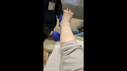 Ankle Fusion