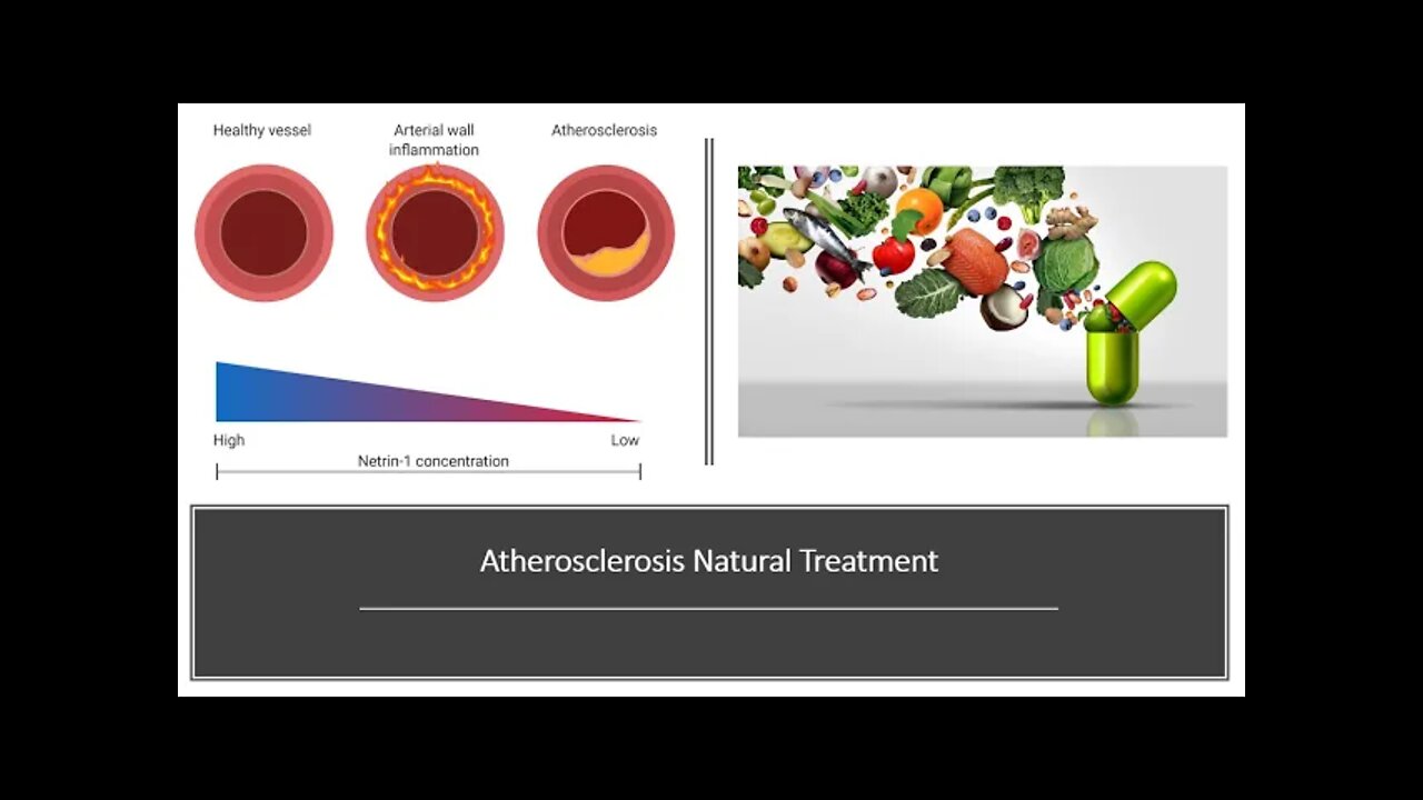 Atherosclerosis Natural Treatment