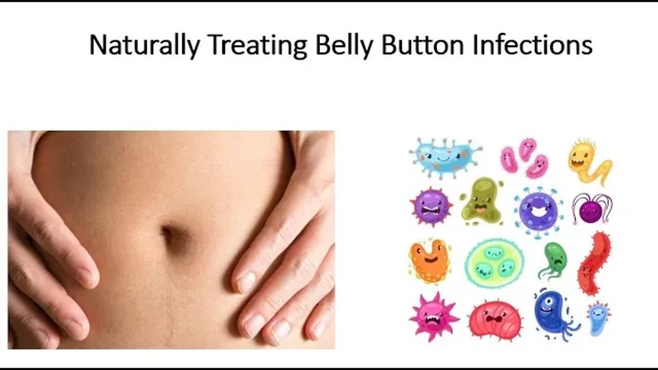 Belly button infections - Natural Treatment Options with Herbal Medicine