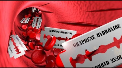 TOP GRAPHENE EXPERT KILLED OVER CLAIMS VACCINE CONTAINS KILLING KNIVES OF GRAPHENE HYDROXIDE