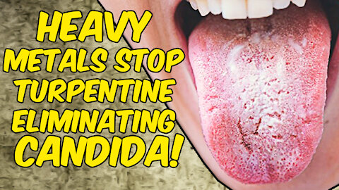 Heavy Metals Stop Turpentine From Eliminating Candida In Your Body!