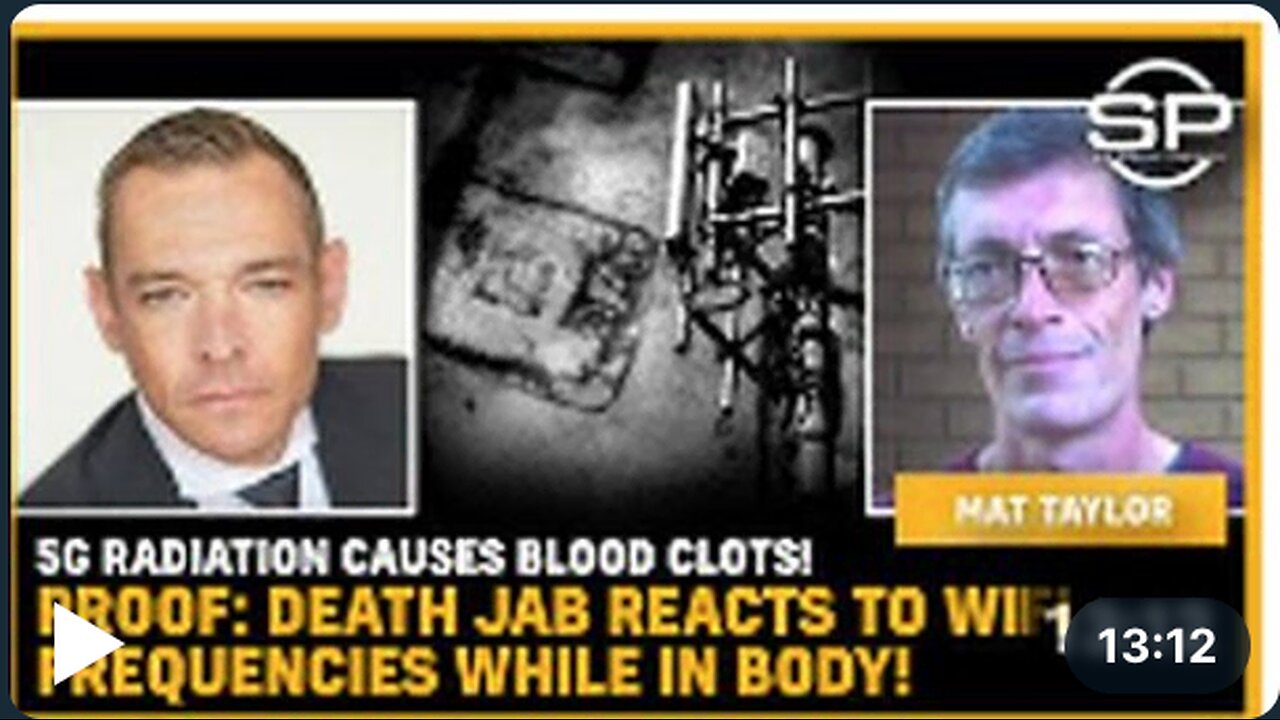 5G Radiation Causes BLOOD CLOTS! PROOF: Death Jab REACTS To WiFi Frequencies While In BODY!