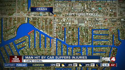 Man hit by car suffers injuries in Cape Coral