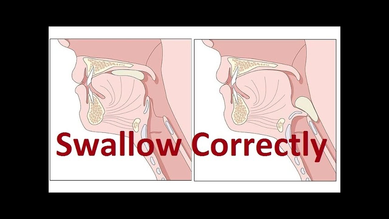 Tips and Exercises on Improving Incorrect Swallowing by Prof John Mew