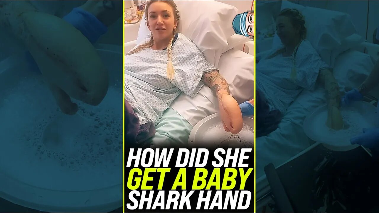 Her Baby Shark Hand Story 😱 #shorts