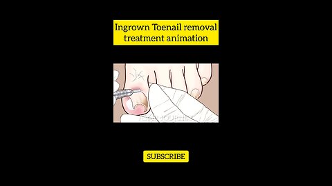 asmr animation