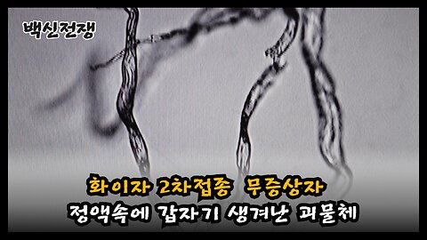 [이영미 원장] 21년 화이자 2차 접종 후 무증상자 정액속 괴물체