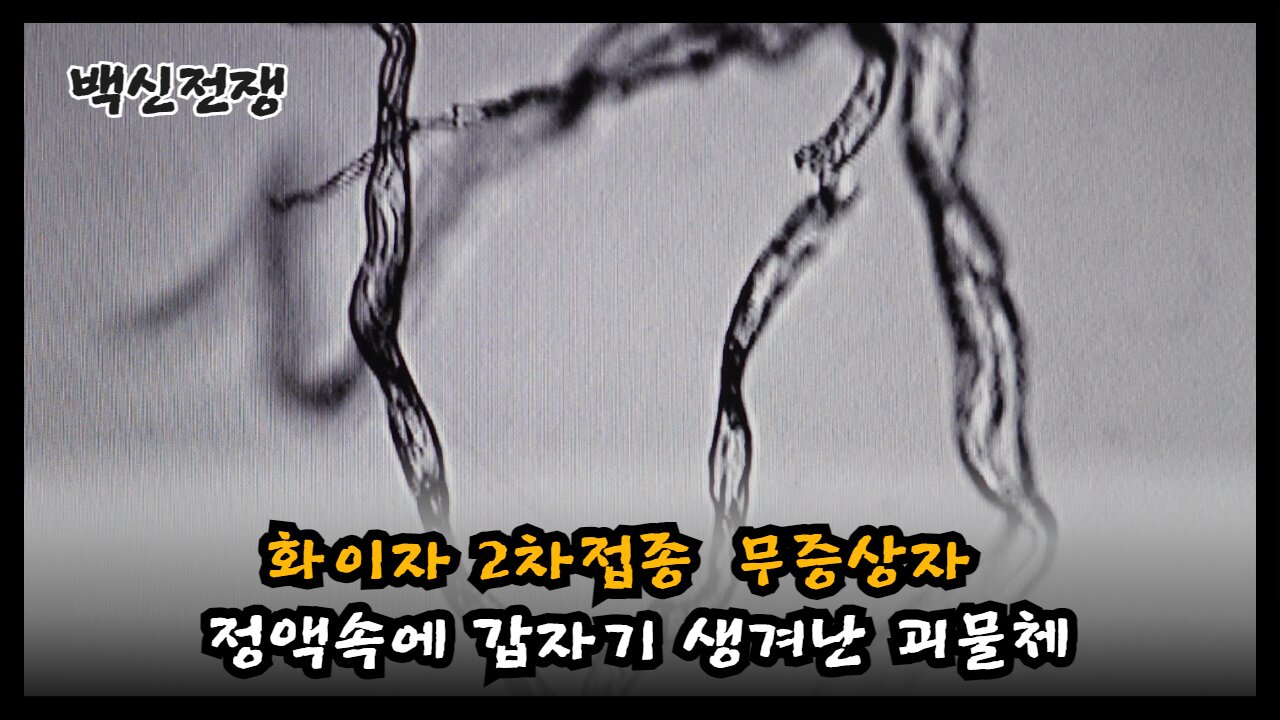 [이영미 원장] 21년 화이자 2차 접종 후 무증상자 정액속 괴물체