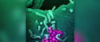 Researchers find COVID-19 can infect multiple organs