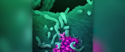 Researchers find COVID-19 can infect multiple organs